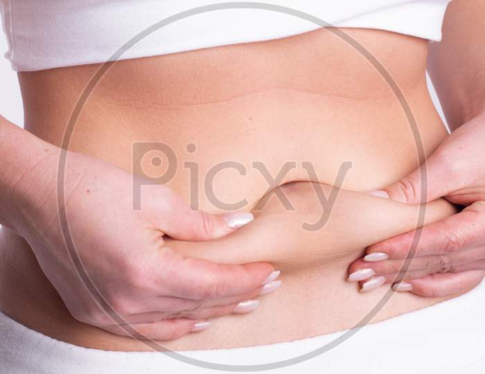A Woman Using Pinch Test As One Of The Methods For Measuring Body Fat