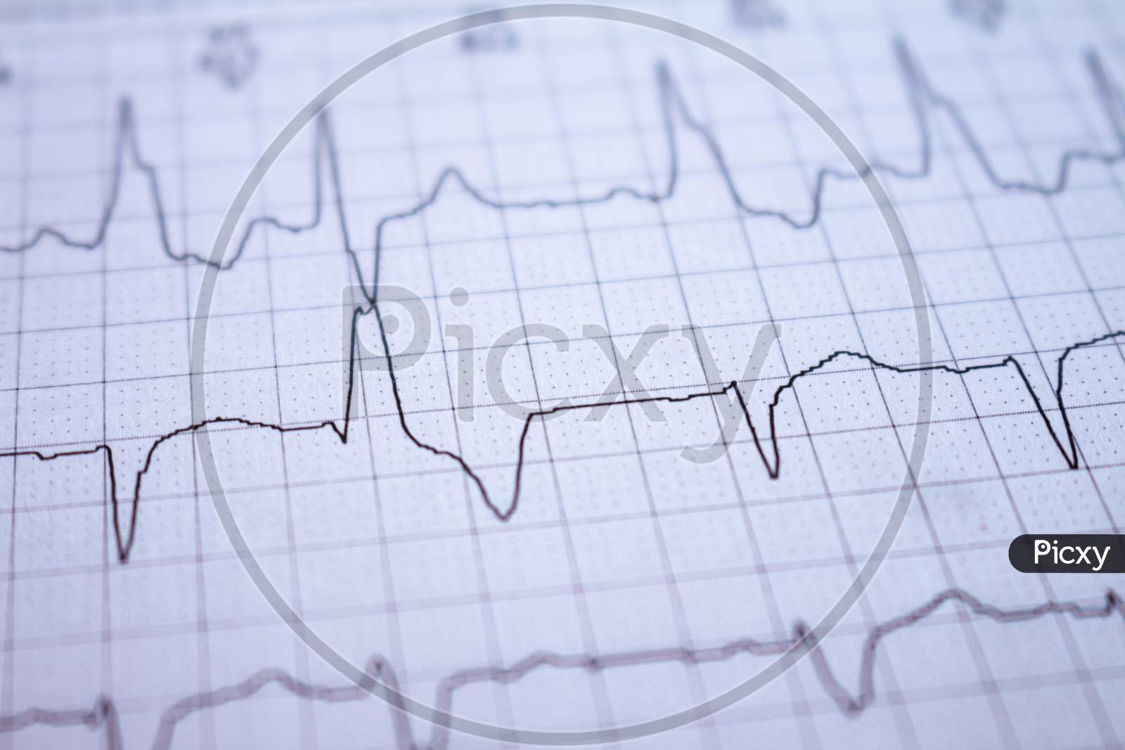 Close-Up Of Heartbeats Recorded On The Paper Of The Electrocardiogram. Selective Focus. Approach To A Cardiac Arrhythmia.