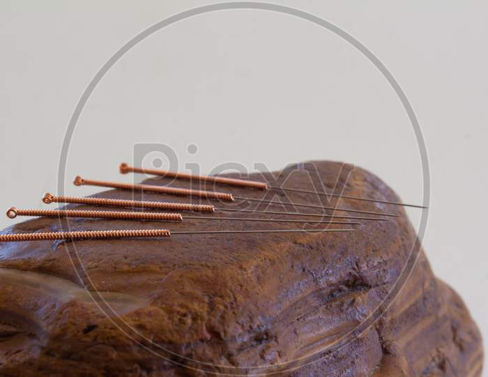 Acupuncture Needles Used By Traditional Chinese Medicine For The Alternative Treatment Of Diseases.