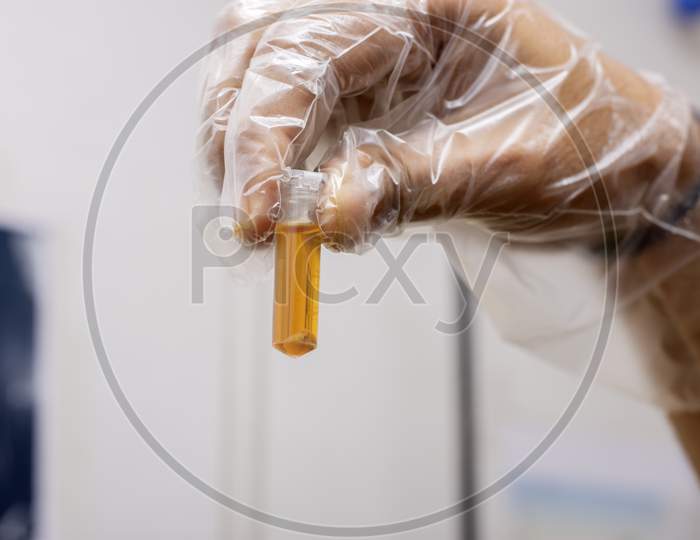 A Scientist Holding A Solution In Test Tube For Testing Bacteria And Germs With Selective Focus.