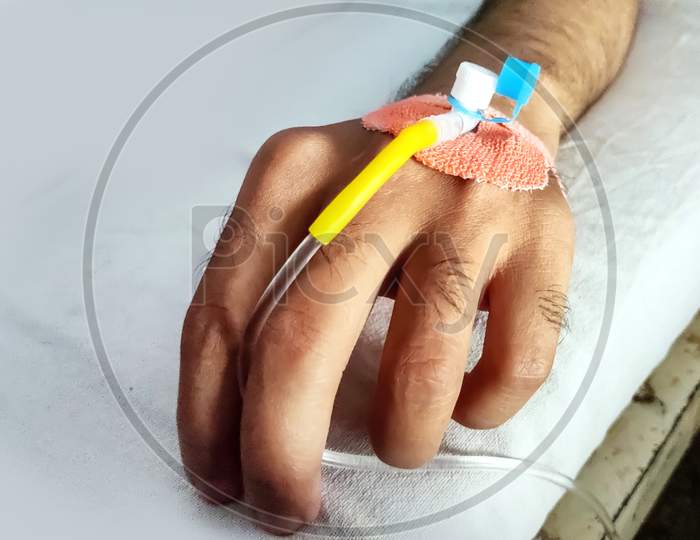 Patient'S Left Hand With Saline Intravenous Dripping In The Hospital