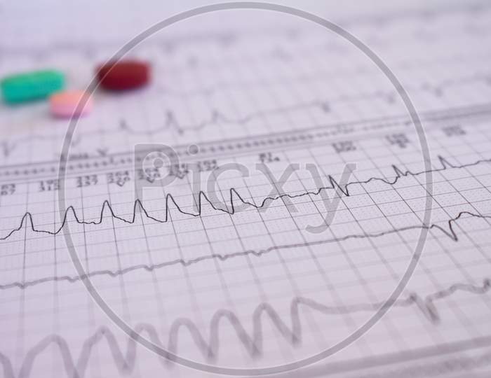 Heartbeat Recorded On Paper. Cardiovascular Study.