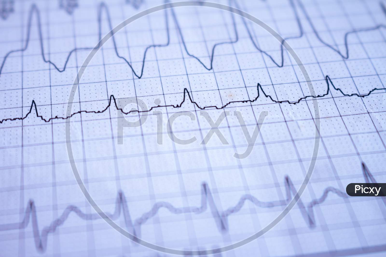 Close-Up On An Electrocardiogram. Heartbeat Written On Paper. Study Of The Heart.