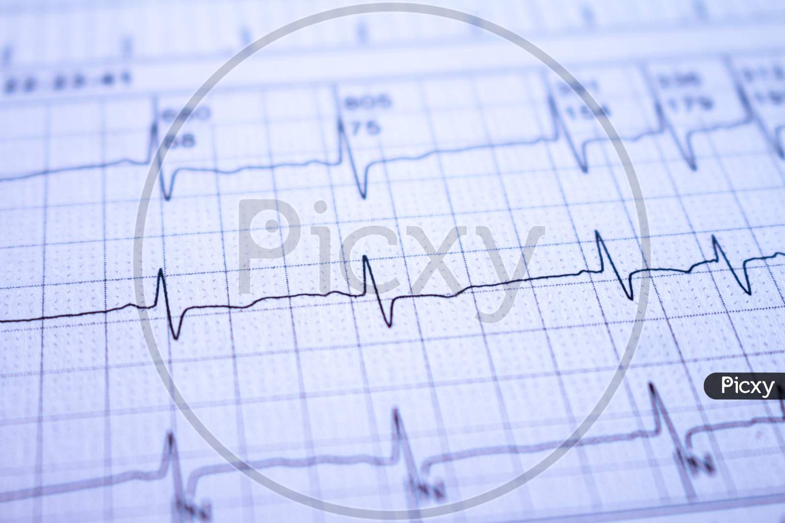 Close-Up Of An Electrocardiogram Of A Patient. Heartbeats Recorded As Waves On Paper.