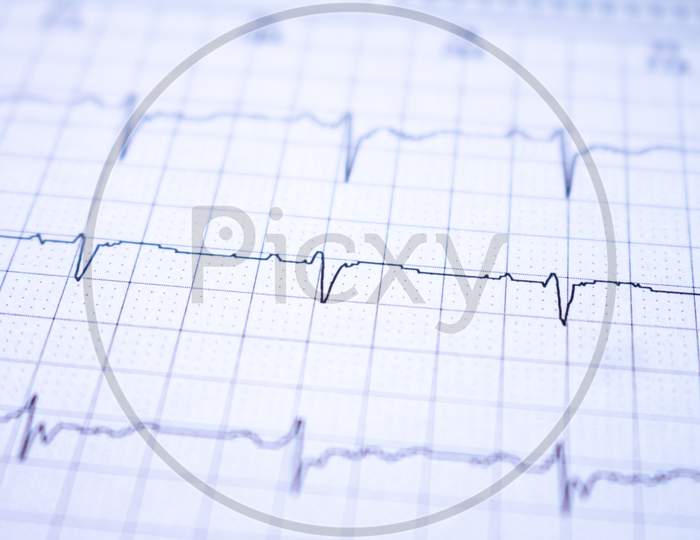 Heart Waves Recorded On Paper Called An Electrocardiogram. Study Of The Heart.
