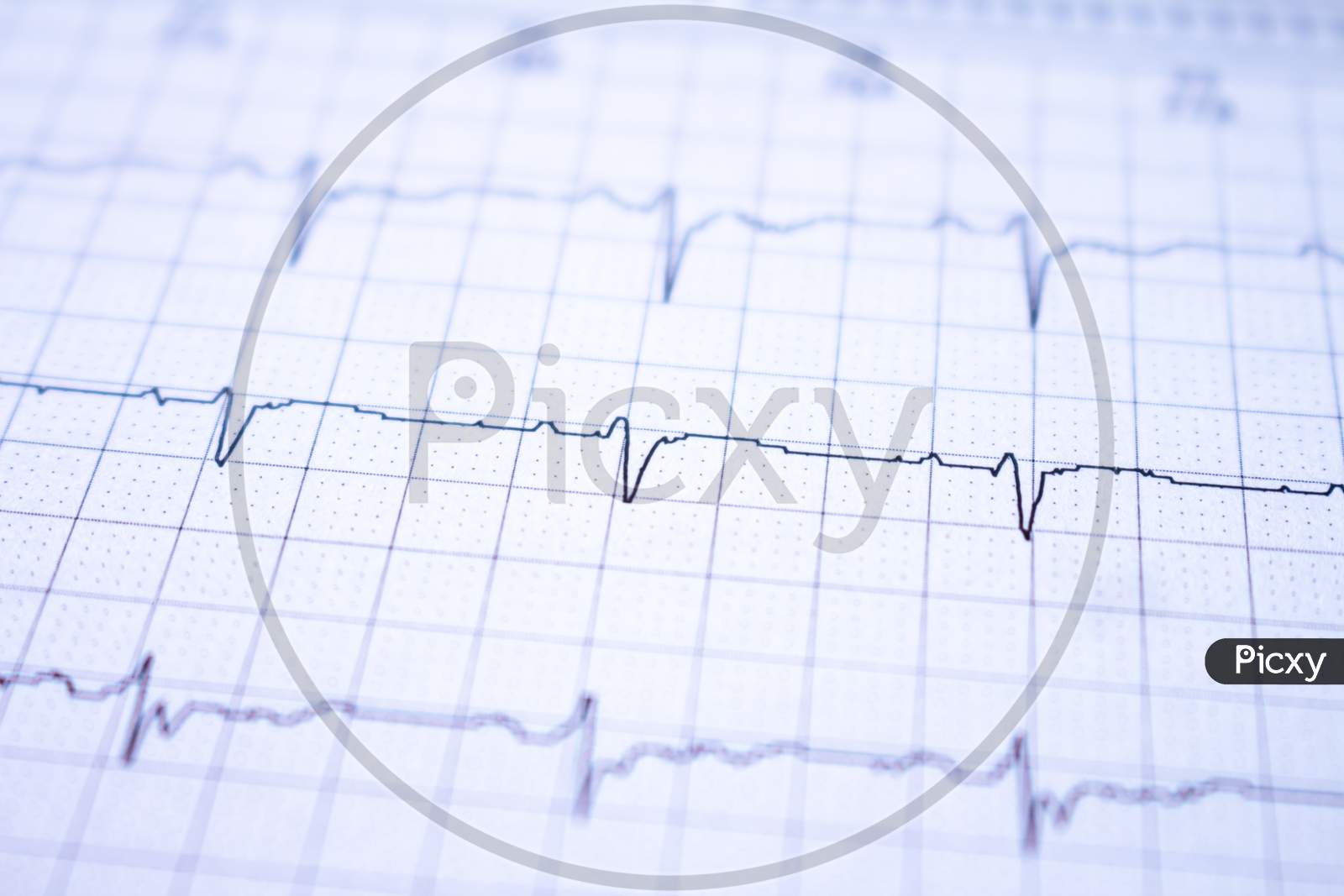 Heart Waves Recorded On Paper Called An Electrocardiogram. Study Of The Heart.